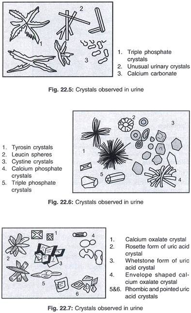 Urine Crystals Chart